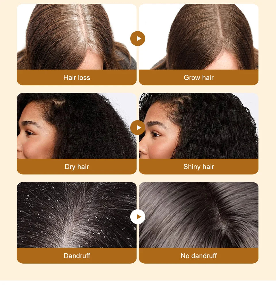 Lewedo Pure Batana Oil Hair Growth Treatmen