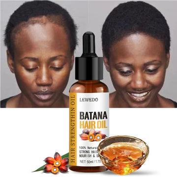 Lewedo Pure Batana Oil Hair Growth Treatmen