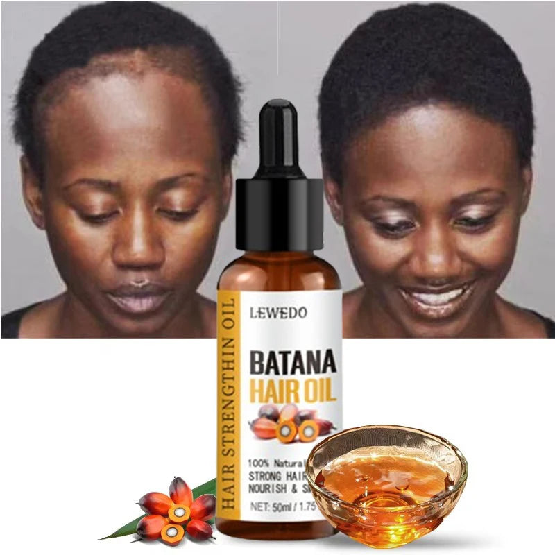 Lewedo Pure Batana Oil Hair Growth Treatmen